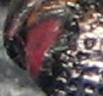 Detalles